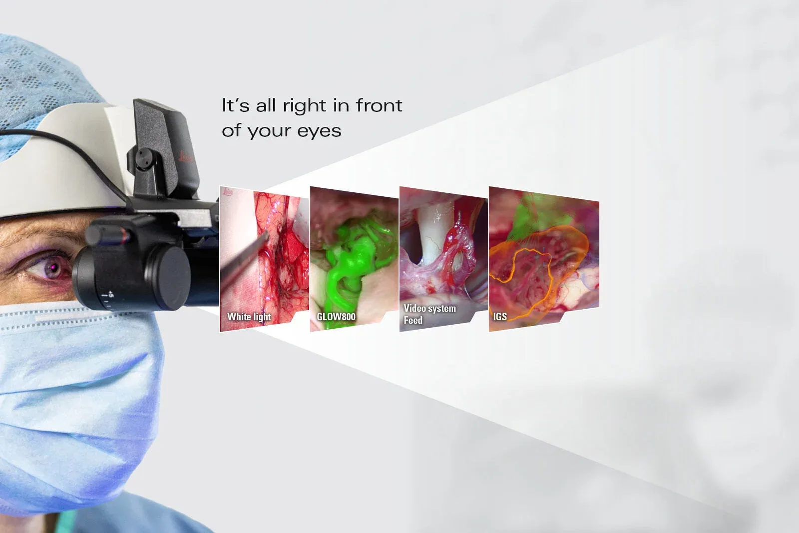 Brainlab, Leica Microsystems и MIT представили современные цифровые технологии для нейрохирургии в Семее